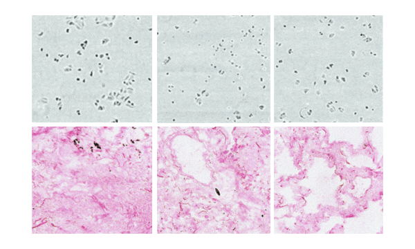 Example of scientific image manipulation detection showing cloned pixel regions duplicated within the same microscopy image, highlighted with red boxes.