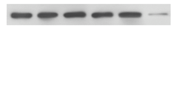 Example of image duplication detection showing a flipped western blot used to appear unique.