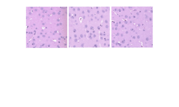 Example of image duplication detection highlighting partial overlap between two histology images, with the shared region marked.