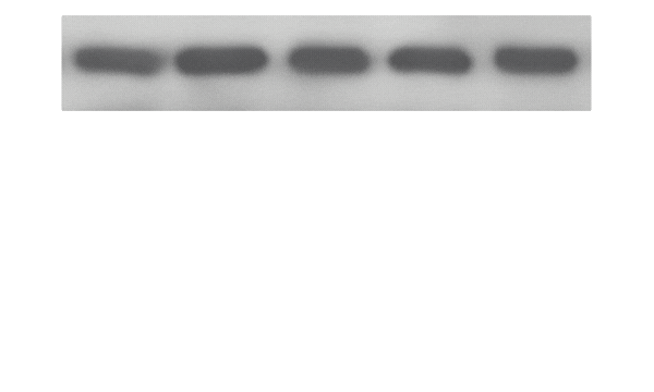Example of image duplication detection showing a rotated western blot reused to disguise repetition.