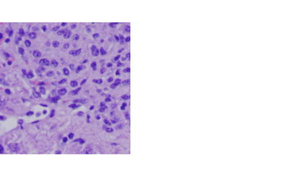 Example of image duplication detection showing a scaled histology image reused as distinct data, with the duplicated region highlighted.