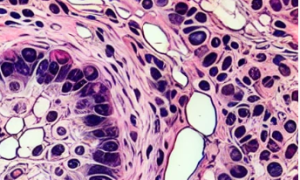 AI-generated histology image showing fabricated tissue structures used to illustrate AI-generated image detection.