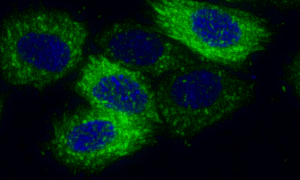 AI-generated fluorescent cell plate image demonstrating how AI-generated image detection flags synthetic colony imagery.