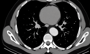 AI-generated medical scan image illustrating synthetic radiological features examined in AI-generated image detection.