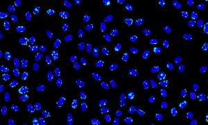 AI-generated microscopy image used to demonstrate how AI-generated image detection identifies synthetic cellular patterns.