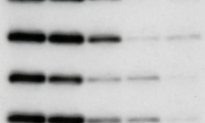 AI-generated western blot and gel pattern showing fabricated band structures used to demonstrate AI-generated image detection.